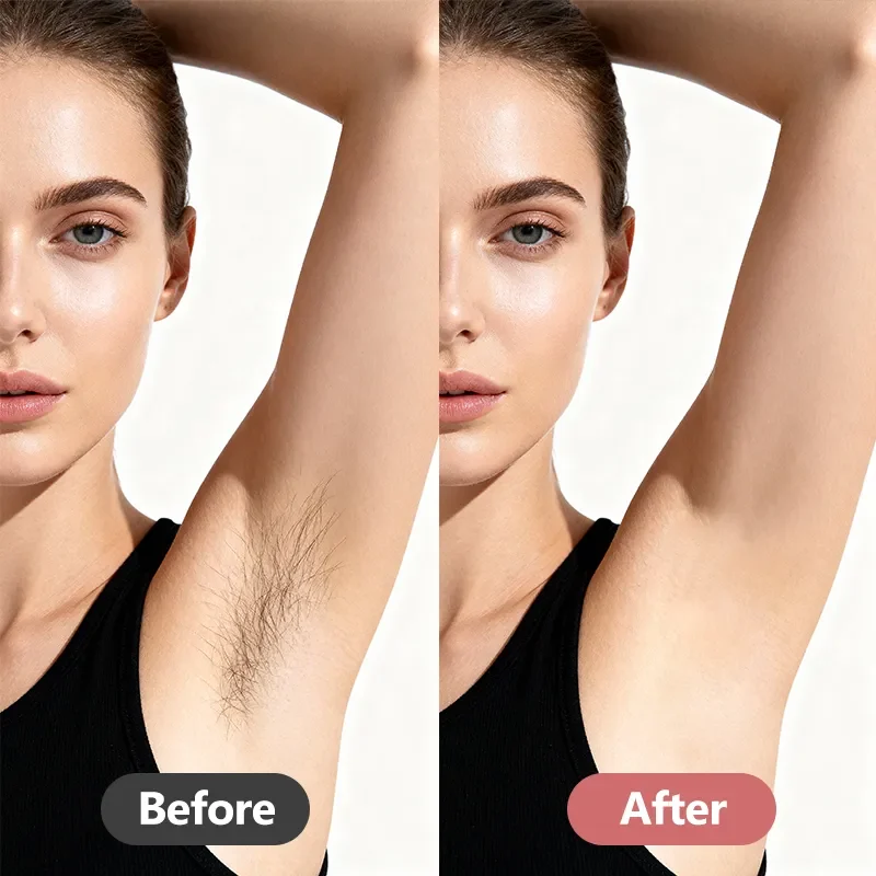 underarms grooming before and after