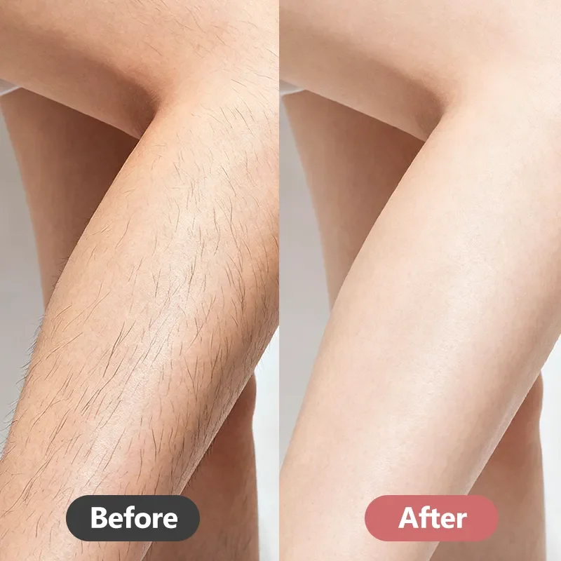 leg grooming before and after