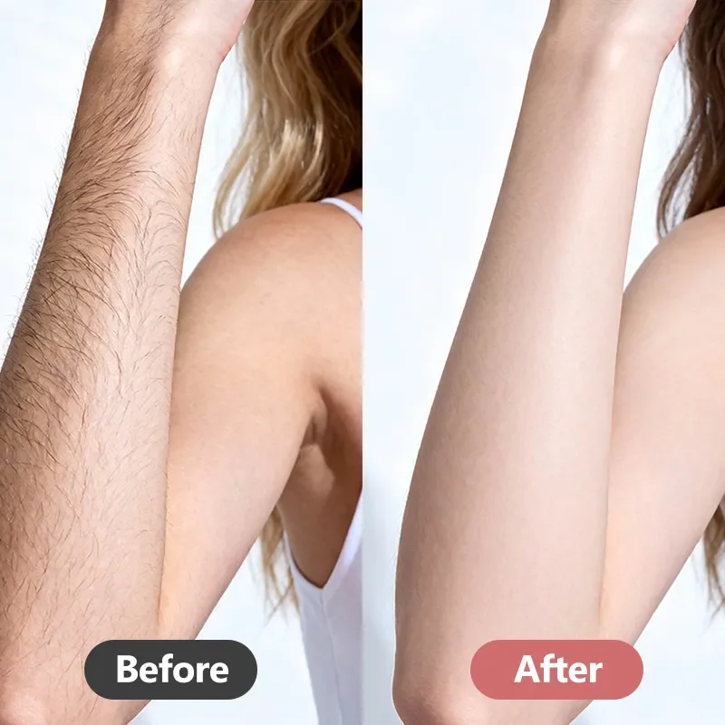 hand grooming before and after